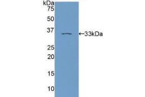Western blot analysis of recombinant Human PKCe. (PKC epsilon Antikörper  (AA 403-672))
