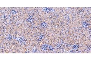 IHC analysis of GLS using anti-GLS antibody (ABIN7601603).