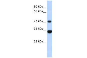 CNP antibody used at 1 ug/ml to detect target protein. (Cnpase Antikörper  (Middle Region))