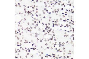 Immunohistochemistry of paraffin-embedded mouse kidney using MonoMethyl-Histone H3-R17 antibody (ABIN3017467, ABIN3017468, ABIN3017469 and ABIN6220100) at dilution of 1:100 (40x lens).