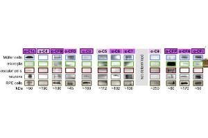 Expression levels of indicated complement components were determined from cells of albino mice at mRNA (bars, 8-week-old mice) and at protein level (western blot, 8- to 24-week -old mice). (Complement Component C9b (C9b) (AA 251-350) Antikörper)