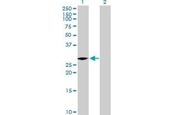 VENTX Antikörper  (AA 1-258)