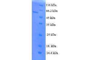 SDS-PAGE (SDS) image for Pituitary Homeobox 3 (PITX3) (AA 1-302), (full length) protein (GST tag) (ABIN5710101) (PITX3 Protein (AA 1-302, full length) (GST tag))