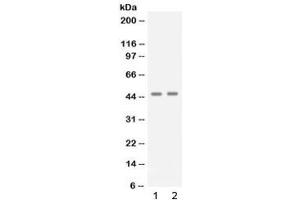 Western blot testing of 1) human A431 and 2) human Jurkat cell lysate with APOBEC3G antibody at 0. (APOBEC3G Antikörper)