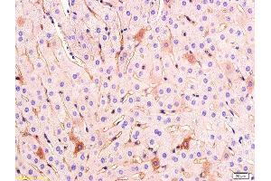 Formalin-fixed and paraffin embedded rabbit liver tissue labeled with Anti VEGF Polyclonal Antibody,Unconjugated (ABIN674829) at 1:200 followed by conjugation to the secondary antibody and DAB staining. (VEGF Antikörper)