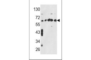 Western blot analysis of CCT3 Antibody (Center) (ABIN389422 and ABIN2839505) in MCF7,CEM,K562,HL-60,Hela cell line lysates (35 μg/lane). (CCT3 Antikörper  (AA 298-326))