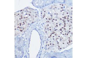 Immunohistochemistry of paraffin-embedded mouse pancreas using NKX6-1 antibody (ABIN7268929) at dilution of 1:50 (40x lens). (NKX6-1 Antikörper)