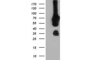Western Blotting (WB) image for anti-N-Myristoyltransferase 2 (NMT2) antibody (ABIN1499781) (NMT2 Antikörper)