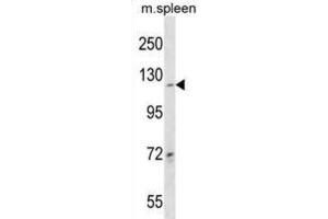 Western Blotting (WB) image for anti-Collagen, Type XIX, alpha 1 (COL19A1) antibody (ABIN3000558) (COL19A1 Antikörper)