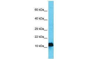 Host: Rabbit  Target Name: Ap4s1  Sample Tissue: Mouse Stomach lysates  Antibody Dilution: 1.