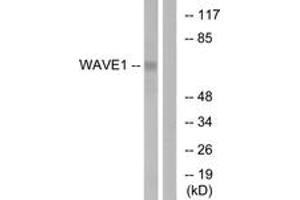 Western blot analysis of extracts from 293 cells, treated with insulin 0. (WASF1 Antikörper  (AA 91-140))