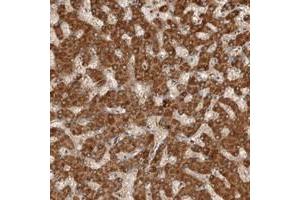 Immunohistochemical staining of human liver with C1orf26 polyclonal antibody  shows distinct cytoplasmic positivity in hepatocytes at 1:200-1:500 dilution. (SWT1 Antikörper)