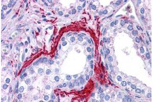 Immunohistochemistry (Formalin-fixed Paraffin-embedded Sections) (IHC (fp)) image for anti-ATG5 Autophagy Related 5 (ATG5) (C-Term) antibody (ABIN6745751)