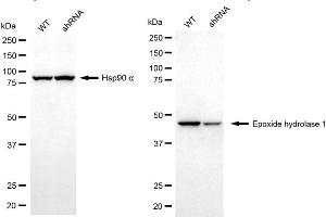 anti-Epoxide Hydrolase 1, Microsomal (Xenobiotic) (EPHX1) antibody