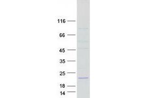 Western Blotting (WB) image for TAF13 RNA Polymerase II, TATA Box Binding Protein (TBP)-Associated Factor, 18kDa (TAF13) protein (Myc-DYKDDDDK Tag) (ABIN2733195)