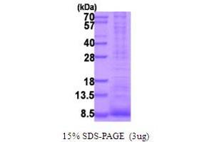 SDS-PAGE (SDS) image for Epiregulin (EREG) (AA 63-108) protein (His tag) (ABIN5854023) (Epiregulin Protein (EREG) (AA 63-108) (His tag))