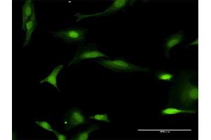Immunofluorescence of purified MaxPab antibody to FANCL on HeLa cell.