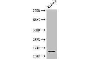 Western Blot Positive WB detected in: Mouse kidney tissue All lanes: MPC2 antibody at 3. (BRP44 Antikörper  (AA 1-40))