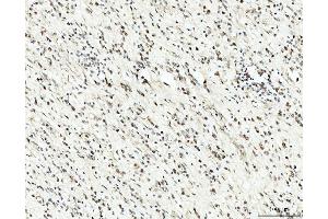 IHC analysis of RRP4/EXOSC2 using anti-RRP4/EXOSC2 antibody (ABIN7602188). (EXOSC2 Antikörper  (AA 62-293))