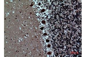 Immunohistochemistry (IHC) image for anti-SAM Domain and HD Domain 1 (SAMHD1) (Internal Region) antibody (ABIN6287282)
