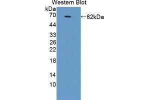 Western blot analysis of the recombinant protein. (GRIA2 Antikörper  (AA 25-543))