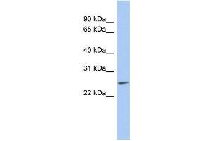 LYPD5 antibody used at 1 ug/ml to detect target protein.