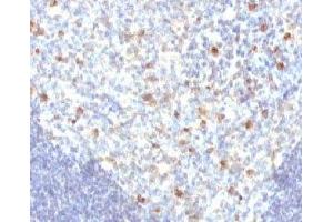 IHC analysis of FFPE human tonsil tissue and IgM antibody (MuHC2) (Maus anti-Human IgM Antikörper)