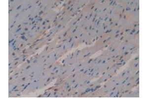 Detection of GSTo1 in Mouse Heart Tissue using Polyclonal Antibody to Glutathione S Transferase Omega 1 (GSTo1)