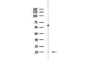 anti-Ubiquitin-Conjugating Enzyme E2T (Ube2t) (Internal Region) antibody