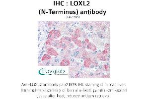 Image no. 1 for anti-Lysyl Oxidase-Like 2 (LOXL2) (N-Term) antibody (ABIN1736517) (LOXL2 Antikörper  (N-Term))