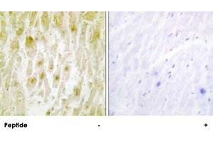 Immunohistochemistry analysis of paraffin-embedded human heart tissue using GTF2E2 polyclonal antibody . (GTF2E2 Antikörper)
