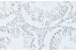 Immunohistochemistry of paraffin-embedded Rat testis using FIP1L1 Polyclonal Antibody at dilution of 1:100 (20x lens).