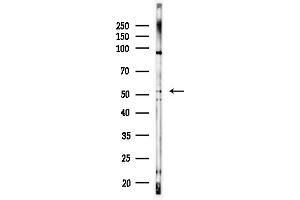 anti-Autophagy related 4D Cysteine Peptidase (ATG4D) (C-Term) antibody