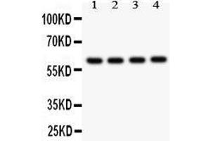 Observed bind size: 60KD (CADM1 Antikörper  (AA 45-340))