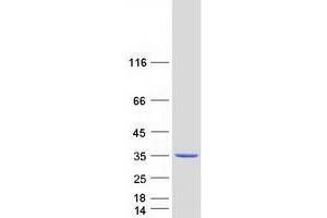 Western Blotting (WB) image for CoA Synthase (COASY) (Transcript Variant 5) protein (Myc-DYKDDDDK Tag) (ABIN2712942)