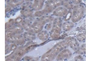 Detection of VARS in Mouse Kidney Tissue using Polyclonal Antibody to Valyl tRNA Synthetase (VARS) (VARS Antikörper  (AA 186-421))