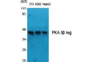 Western Blot (WB) analysis of specific cells using PKA IIbeta reg Polyclonal Antibody. (PKA IIbeta Reg (Thr286) Antikörper)