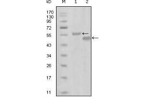 Western blot analysis using EphA6 mouse mAb against truncated MBP-EphA6 recombinant protein (1) and truncated GST-EphA6(aa695-795) recombinant protein (2). (EPH Receptor A6 Antikörper  (AA 695-795))