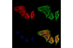 ABIN6265660 and ABIN6279885 staining Hela cells by IF/ICC. (TNNT1 Antikörper  (N-Term))