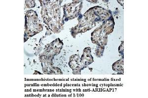Image no. 1 for anti-rho GTPase Activating Protein 17 (ARHGAP17) antibody (ABIN1574792) (ARHGAP17 Antikörper)