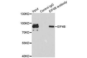 Immunoprecipitation analysis of 200ug extracts of 293T cells using 1ug EIF4B antibody. (EIF4B Antikörper)