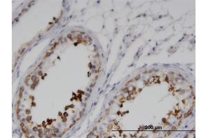 Immunoperoxidase of monoclonal antibody to GKAP1 on formalin-fixed paraffin-embedded human testis. (GKAP1 Antikörper  (AA 1-366))