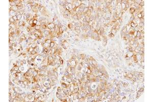 IHC-P Image Immunohistochemical analysis of paraffin-embedded H661 xenograft, using DOK1, antibody at 1:500 dilution. (DOK1 Antikörper)