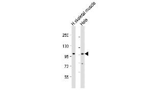 All lanes : Anti-ATXN2 Antibody (Center) at 1:2000 dilution Lane 1: human skeletal muscle lysate Lane 2: Hela whole cell lysate Lysates/proteins at 20 μg per lane.
