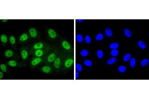 HepG2 cells were stained with SIRT1(T530) (6H5) Monoclonal Antibody  at [1:200] incubated overnight at 4C, followed by secondary antibody incubation, DAPI staining of the nuclei and detection. (SIRT1 Antikörper  (pThr530))
