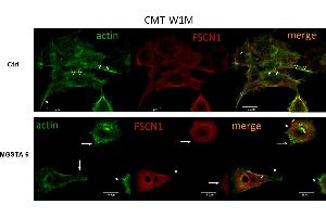 Representative confocal microscopy images of cytoskeletal protein F-actin and fascin 1 in CMT-W1M canine carcinoma cell line. (Fascin Antikörper  (pSer39))