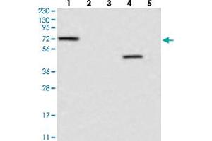 Western blot analysis of Lane 1: RT-4, Lane 2: U-251 MG, Lane 3: Human Plasma, Lane 4: Liver, Lane 5: Tonsil with LRRC40 polyclonal antibody  at 1:250-1:500 dilution. (LRRC40 Antikörper)