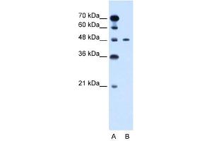 WB Suggested Anti-PBX1 Antibody Titration: 0. (PBX1 Antikörper  (N-Term))