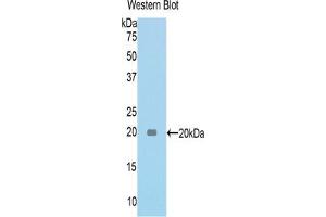 Western blot analysis of the recombinant protein. (TNC Antikörper  (AA 175-342))
