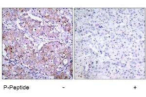 Image no. 1 for anti-Epidermal Growth Factor Receptor (EGFR) (pSer1070) antibody (ABIN196758) (EGFR Antikörper  (pSer1070))
